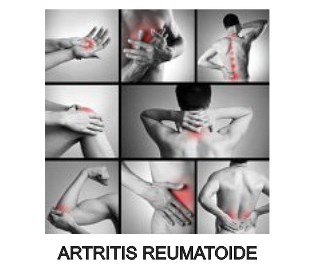 artritis reumatoide artriplus oroverde