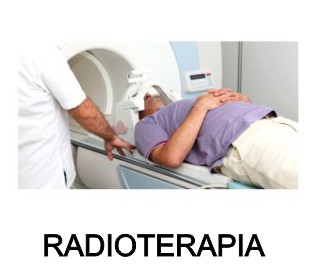 radioterapia moringapura ca